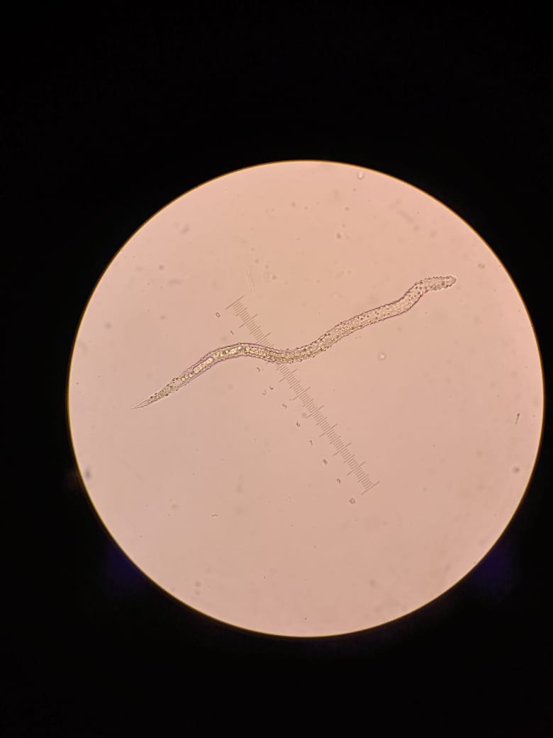 Light microscope view of Pasteuria spore attachment on second-stage juveniles of Meloidogyne