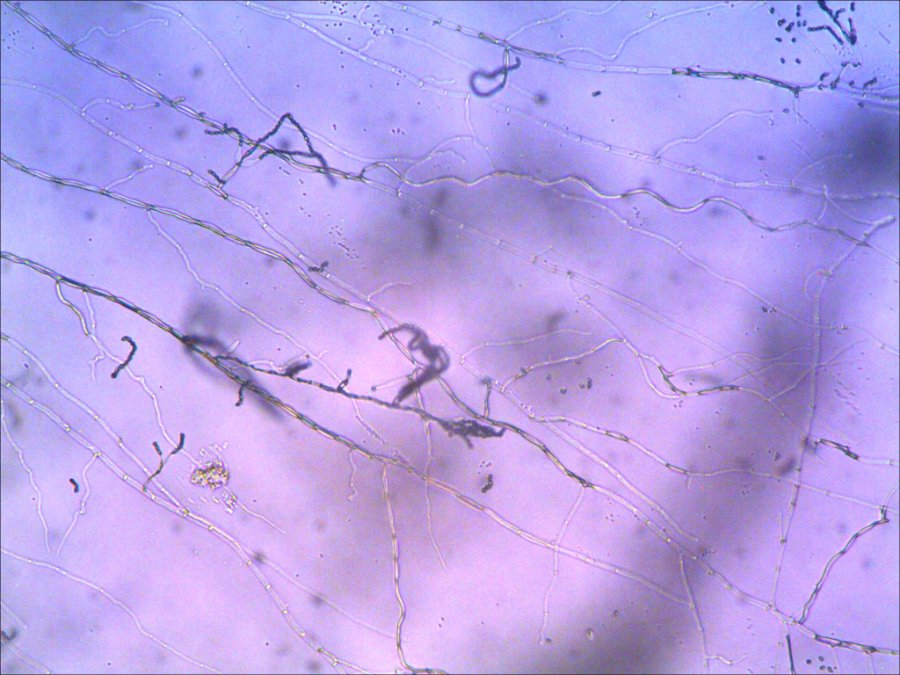 Light microscopic image of phialides and conidia of Purpureocillium lilacinum