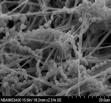 Scanning electron micrograph of Purpureocillium lilacinum